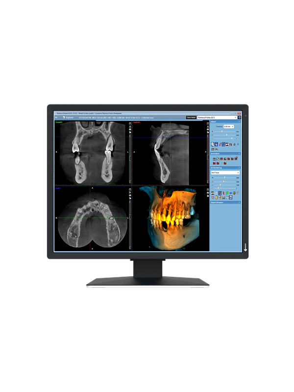 EIZO RadiForce MX217-SB 21" IPS 1200 x 1600 pixel No-OS